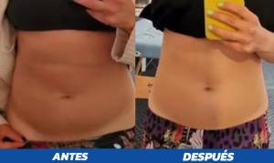 antes y despues PROSCULPT